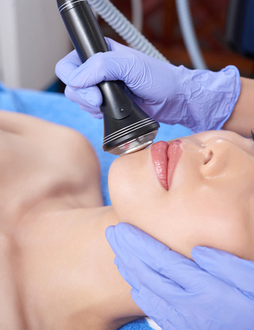 Eksozom Uygulaması, Alloblast Uygulaması