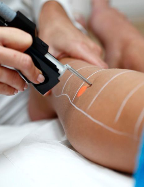 Epilasyon - Alexandriate Epilasyon